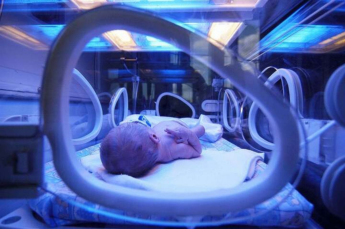 A newborn baby getting treated for jaundice under ultraviolet light in an incubator at a neonatal intensive care unit (NICU). Photo by Petr Bonek/ shutterstock.com.